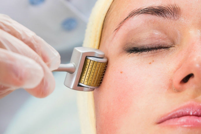 Can Micro-Needling Banish Aging Skin For Good?