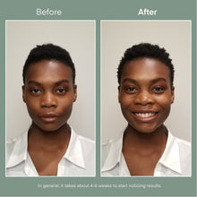 Load image into Gallery viewer, 1 X MICROSTEM SHAMPOO SUB CMS
